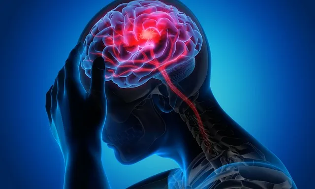 Migraines: Nutritional Triggers and Prevention