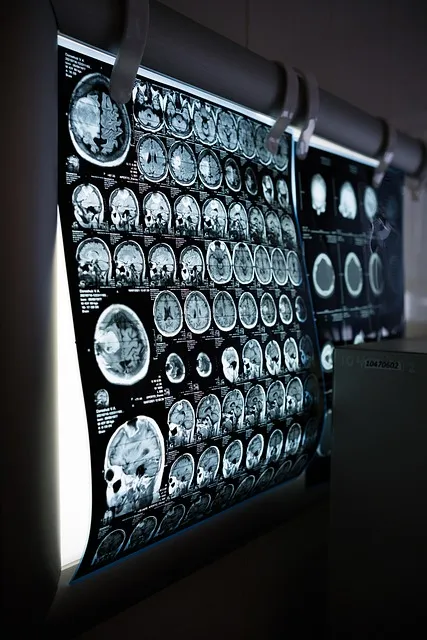 The 90-Day Neural Rewire Protocol — brain scan medical