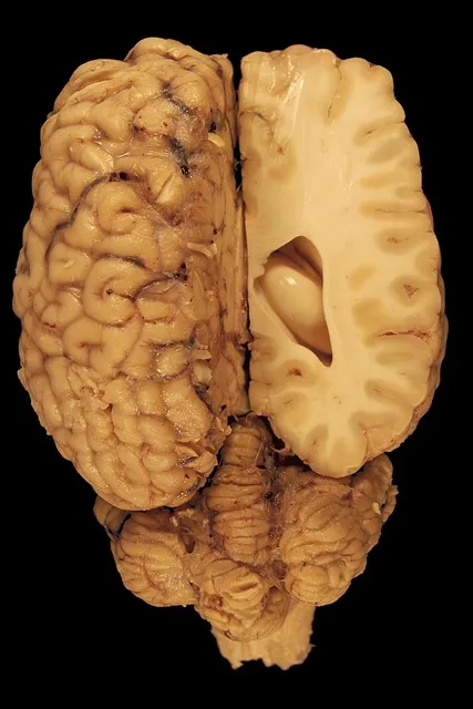 Dorsal vagal shutdown as the deepest layer of nervous system defense not a
