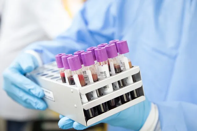What People Ask About Standard Lab Reference