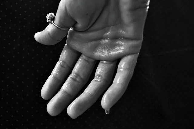 hand, hyperhidrosis, sweating, sweat glands, externalization, purification,