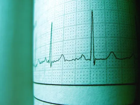Close-up of an ECG printout displaying heartbeat rhythm and frequency for