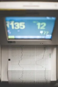 High-resolution image of a medical ECG machine showing heart rate data.