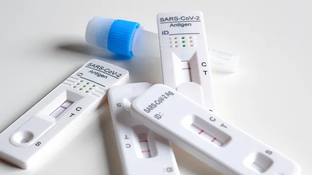 antigen, quick test, corona, covid, test, covid-19, antigen, antigen,