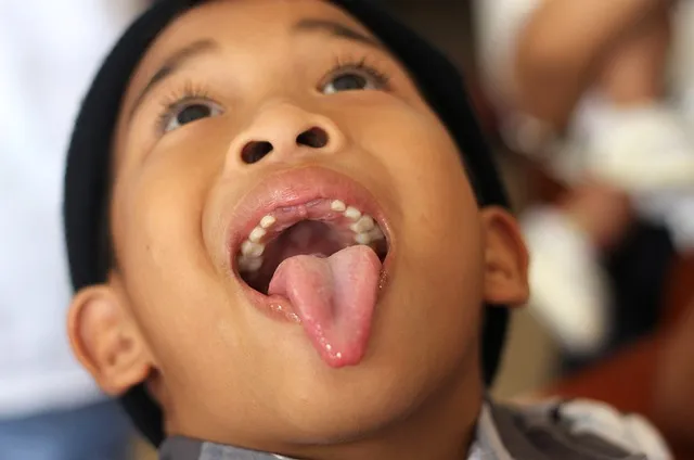 tongue, teeth, boy, portrait, face, cute, fluorides, fluoride, nose, mouth,