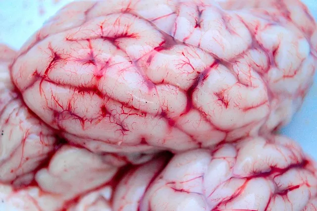 brain, neurology, spirit, anatomy, medicine, psychology, mental, thought,