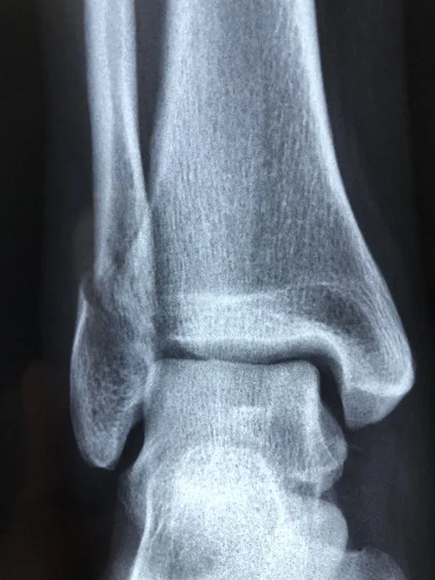 radiography, diagnosis, anatomy, injury, radiology, bone, healthcare, xray,