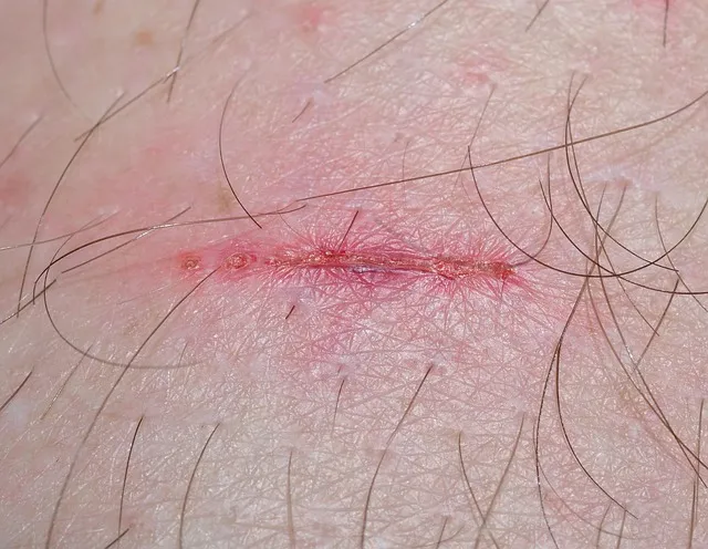 wound, injury, time heals all wounds, place of miracles, consolation, fresh,