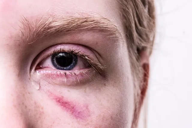 trauma, injured, tear, traumatized, pain, injury, cry, hematoma, tormented,