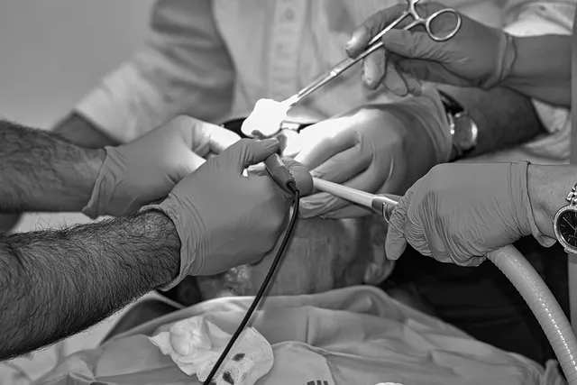 anesthesia, hospital, surgery, patient, operation, doctor, op, scalpel,