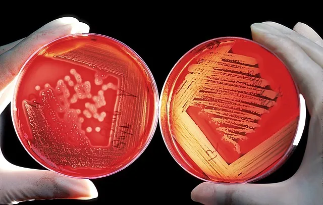 agar, breeding ground, red, blood cells, experiment, research, agar agar,