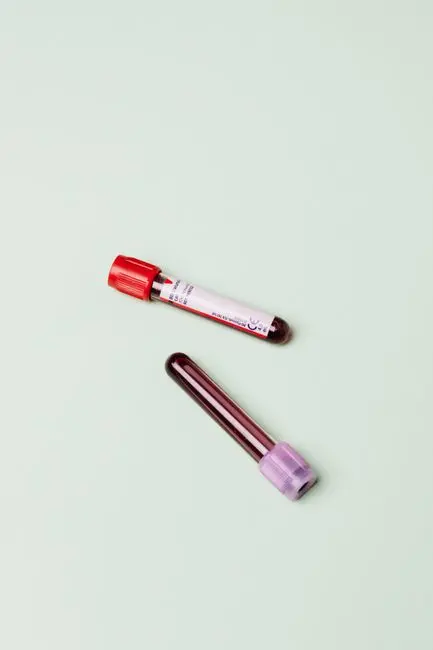 DUTCH TEST VS STANDARD HORMONE PANEL: WHICH TEST GIVES YOU BETTER INFORMATION